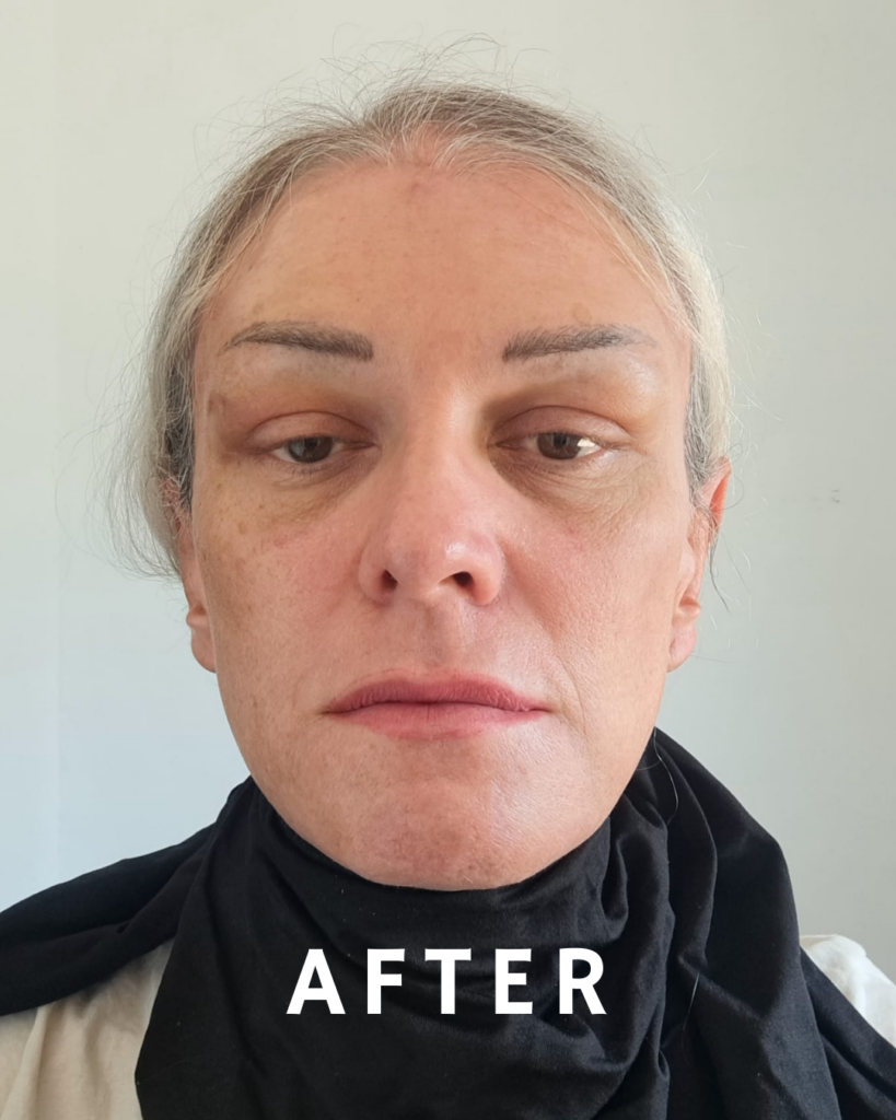 Ein Nahaufnahmeporträt einer Person, die ein schwarzes Hemd mit dem Wort „AFTER“ in weißen Buchstaben trägt. Die Person hat helles Haar und blickt mit neutralem Gesichtsausdruck direkt in die Kamera.