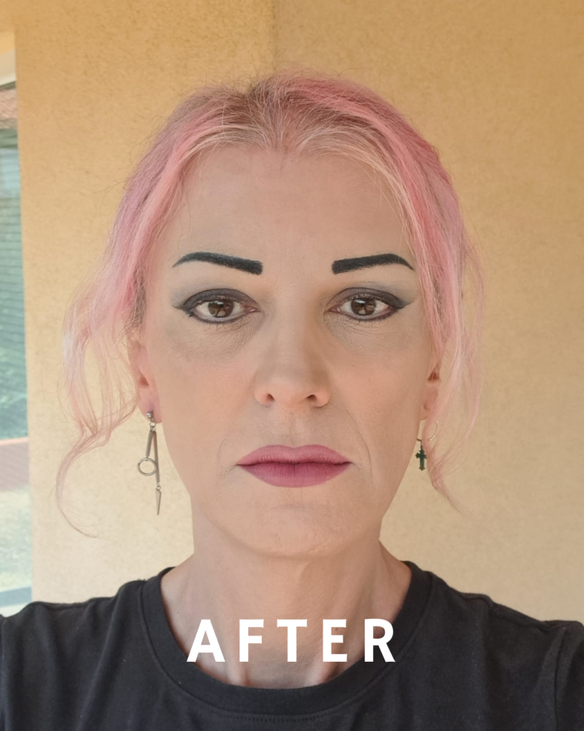 Ein Nahaufnahmeporträt einer Person mit rosa Haaren, kräftigen schwarzen Augenbrauen und baumelnden Ohrringen. Der Hintergrund ist eine neutrale, helle Wand mit einem vertikalen hellblauen Streifen. Der Gesichtsausdruck der Person ist ernst, und das Wort „NACHHER“ ist deutlich am unteren Bildrand zu sehen.