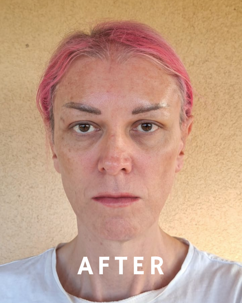 Eine Person mit kurzen rosa Haaren blickt mit neutralem Gesichtsausdruck direkt in die Kamera. Die Person trägt ein hellgraues Hemd und steht vor einer schlichten, hellen Wand. Am unteren Bildrand ist in weißen Buchstaben deutlich das Wort „NACHHER“ zu sehen.