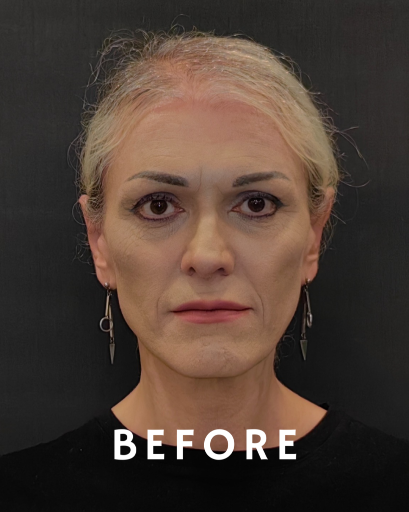 Vorher-Foto einer Frau mit blonden Haaren, schwarzer Kleidung und baumelnden Ohrringen vor einem dunklen Hintergrund.