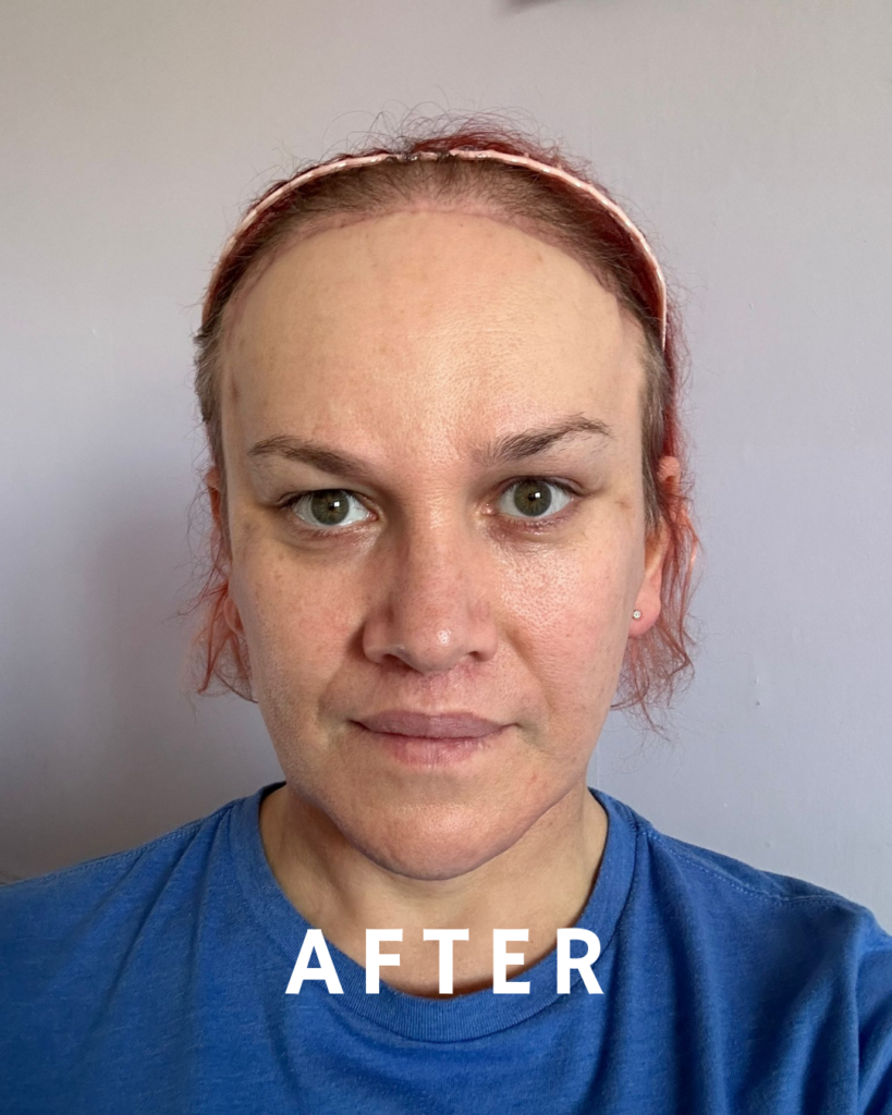 Eine Frau mit heller Haut und zurückgekämmtem rötlichem Haar, die ein blaues Hemd trägt und direkt in die Kamera blickt. Das Wort „NACHHER“ ist in weißer Schrift am unteren Bildrand eingeblendet.