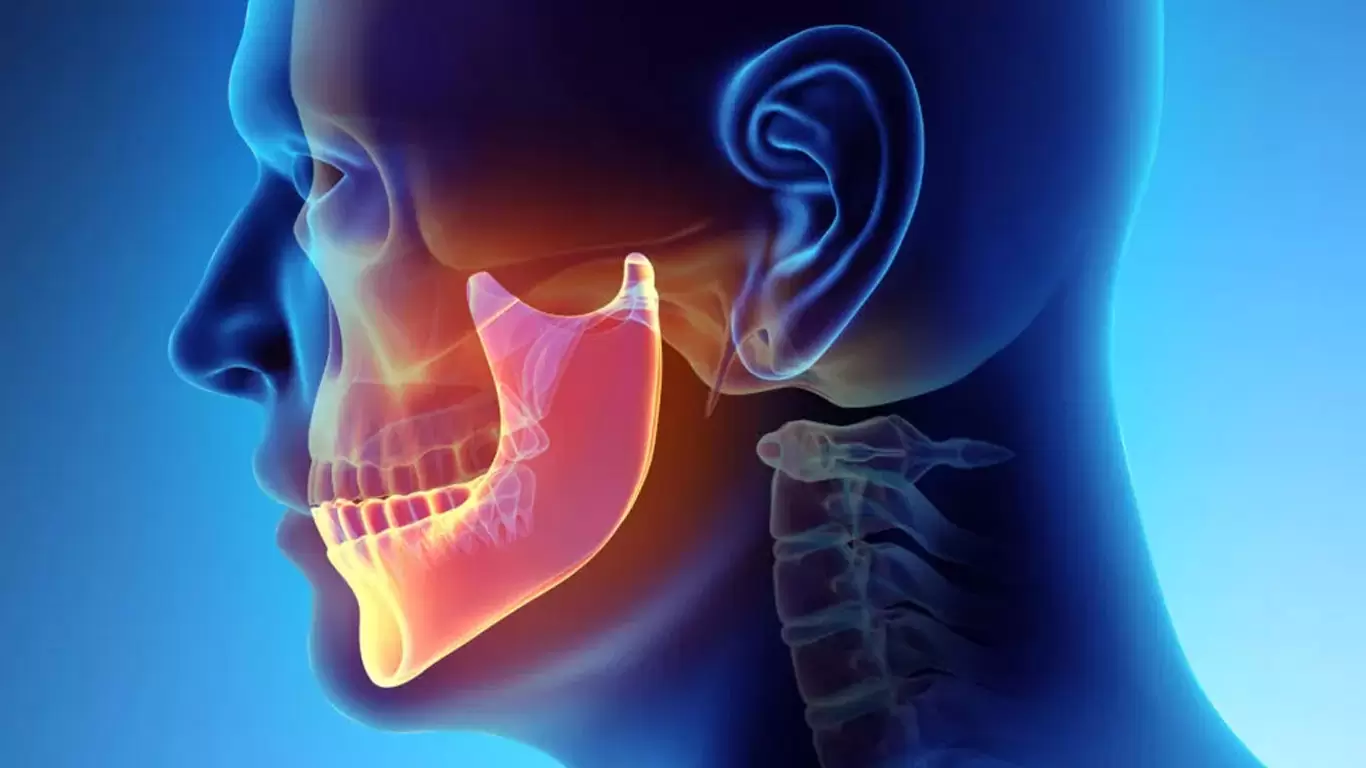 Reducción del ángulo mandibular para perfil femenino | Dr. MFO