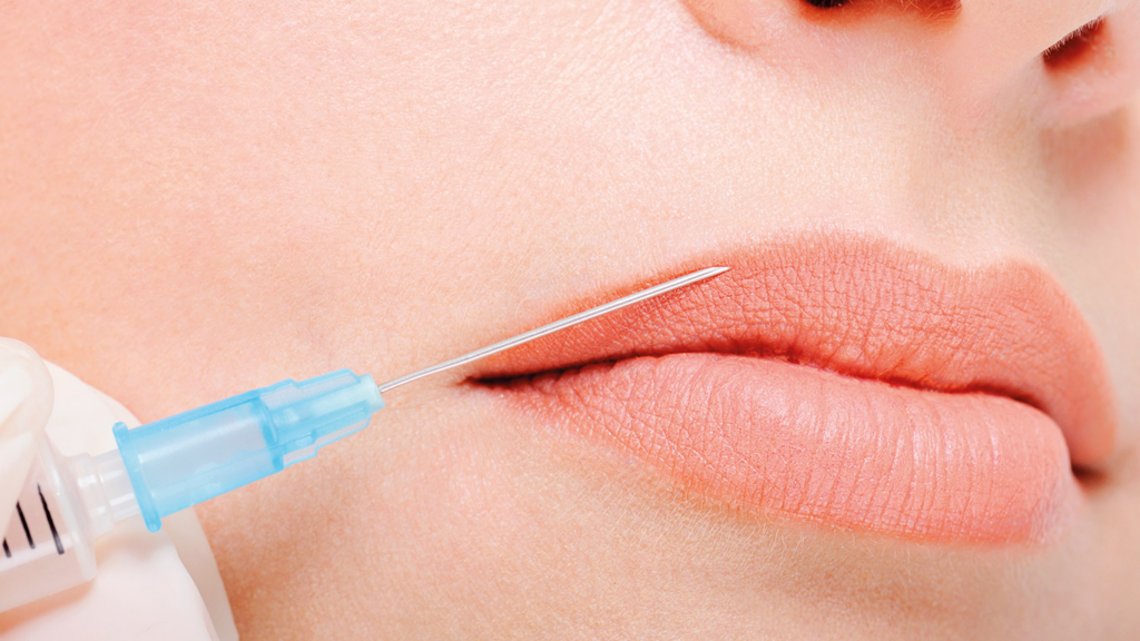 Queiloplastia: una descripción general