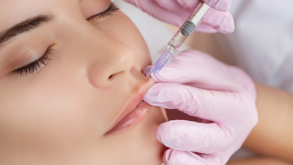 Queiloplastia: una guía completa 1