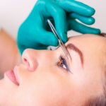 Blepharoplasty: Banish Tired Eyes and Look Years Younger