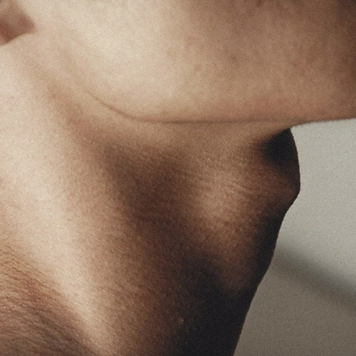 A close-up photograph of a person's neck, showing detailed skin texture and the underside of the chin.