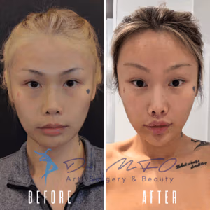 Before and after images of a woman with bleached eyebrows, showing the transformation from lightened eyebrows to natural dark eyebrows.