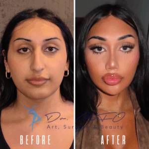 Сравнение фотографий молодой женщины до и после. На фото «до» изображено естественное лицо с минимальным количеством макияжа. На фото «после» та же женщина с более выраженными чертами лица, очерченными скулами, более густыми бровями и густыми ресницами.