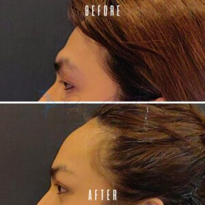 Ein Vorher-Nachher-Vergleich, der die Ergebnisse einer Haarbehandlung zeigt. Das Vorher-Bild zeigt das Haar in einem unordentlichen und ungepflegten Zustand, während das Nachher-Bild dasselbe Haar ordentlich gestylt und gepflegt zeigt.