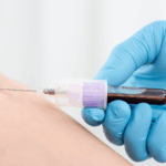 Una mano con un guante azul sostiene una jeringa con una aguja apuntando hacia el brazo de una persona, probablemente para una inyección.