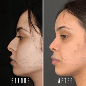 Avant Après FFS Galerie 2