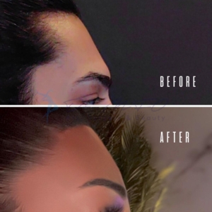 Avant Après FFS Galerie 11