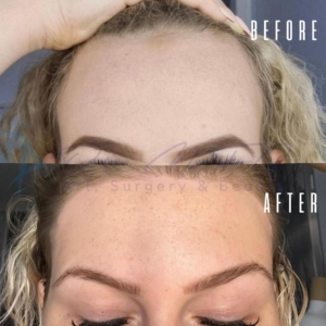 Avant Après FFS Galerie 13