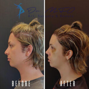 Before After FFS Gallery 22