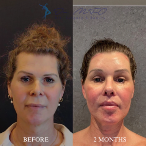 Before After FFS Gallery 23