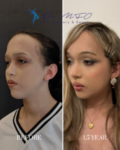 Before After FFS Gallery 40