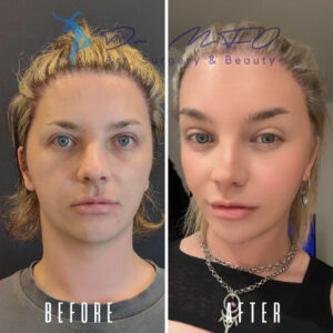 Before After FFS Gallery 26