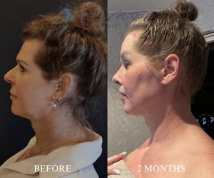 Before After FFS Gallery 30