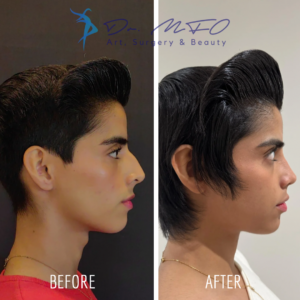 Before After FFS Gallery 31