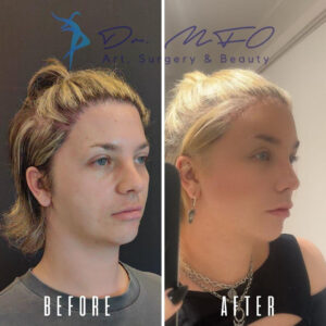 Before After FFS Gallery 32