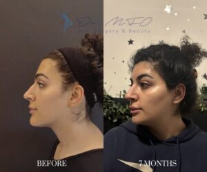 Before After FFS Gallery 34