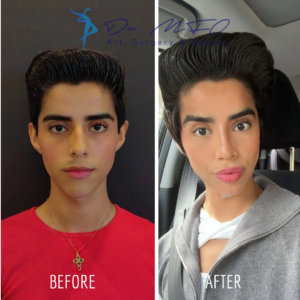 Before After FFS Gallery 35