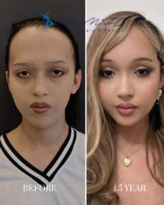 Before After FFS Gallery 37