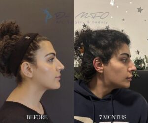 Before After FFS Gallery 36