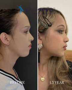 Before After FFS Gallery 39