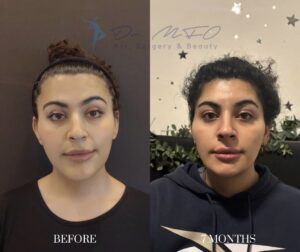 Before After FFS Gallery 38