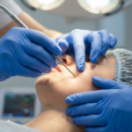A high-resolution, professional clinical photograph captured with an 85mm macro lens, showcasing a precise medical aesthetic procedure. The shot emphasizes exceptional clarity and 4K-level detail, focusing on the intersection of the practitioner's gloved hands and the patient's facial features. The lighting is bright, clinical, and evenly diffused to minimize harsh shadows while accentuating the sterile environment. The practitioner, wearing textured blue nitrile gloves, skillfully uses a fine-tipped metal instrument near the patient's nasolabial fold. The patient, reclined and composed, is seen wearing a protective hair cap, with their skin texture appearing smooth and meticulously prepared. The composition is tight and purposeful, highlighting the technical expertise and sterile precision of the procedure. The background is softly out-of-focus, suggesting a modern, high-end medical clinic setting with diagnostic equipment visible as a blurred secondary element, creating a sense of professional, clinical intimacy.